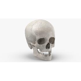Real Human Female Skull With Jaw Damaged 02 White 3D model